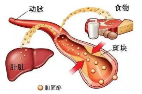 近些年很多人對膽固醇退避三舍