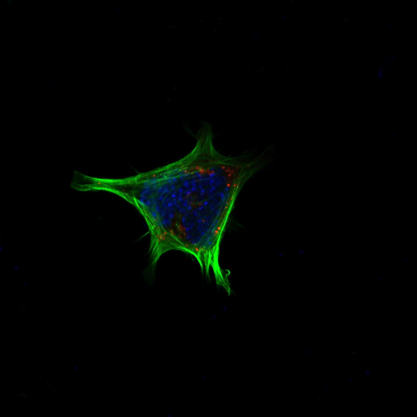 EPFL科學家發(fā)現(xiàn)了膽汁酸的新作用：它們通過進入大腦來抑制食欲