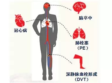 研究人員將使用數(shù)字技術(shù)幫助應(yīng)對慢性病