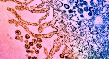 抗生素分子可使免疫系統(tǒng)殺死感染HIV的細(xì)胞