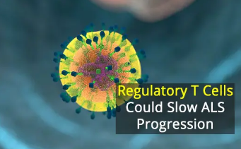 免疫細胞有希望減慢ALS病情