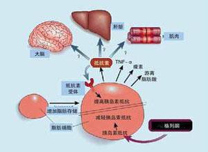 研究表明 更年期會增加代謝綜合征的風(fēng)險