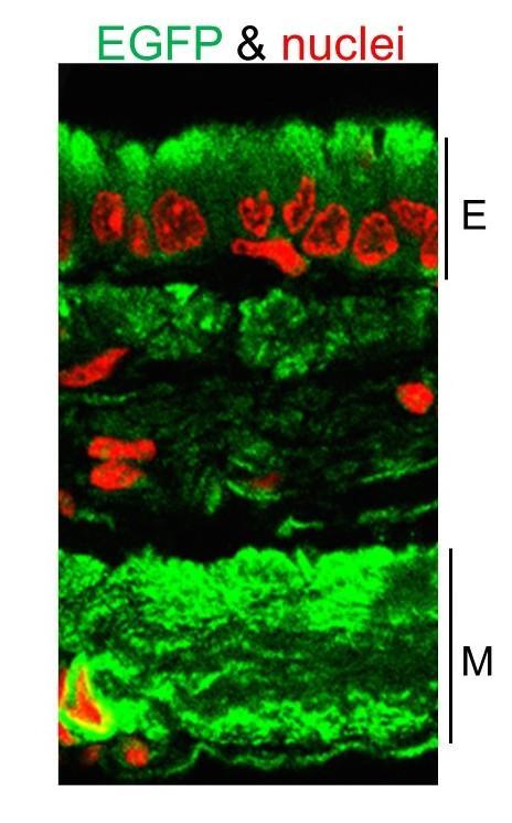 科學(xué)家展示了治療囊性纖維化的有希望的新方法