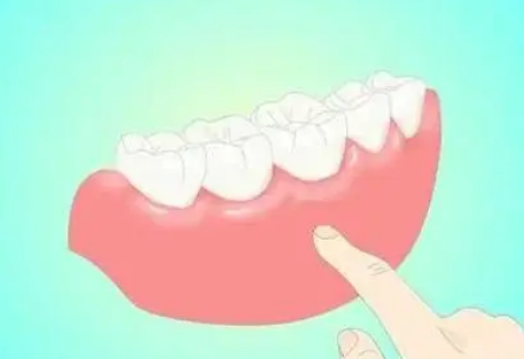 研究發(fā)現(xiàn)牙齦疾病會增加患其他疾病的風(fēng)險