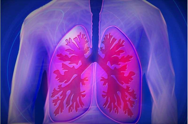 分析顯示罕見的呼吸道疾病 PCD 比以前認(rèn)為的更常見