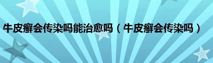 牛皮癬會(huì)傳染嗎能治愈嗎（牛皮癬會(huì)傳染嗎）