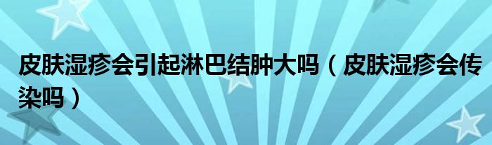 皮膚濕疹會引起淋巴結(jié)腫大嗎（皮膚濕疹會傳染嗎）