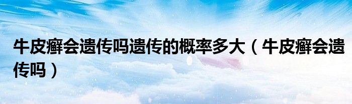牛皮癬會遺傳嗎遺傳的概率多大（牛皮癬會遺傳嗎）