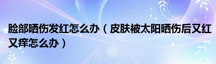 臉部曬傷發(fā)紅怎么辦（皮膚被太陽曬傷后又紅又癢怎么辦）