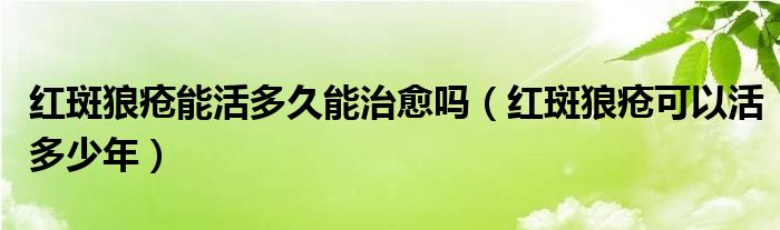 紅斑狼瘡能活多久能治愈嗎（紅斑狼瘡可以活多少年）