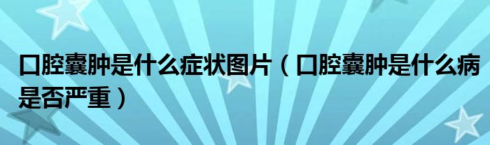 口腔囊腫是什么癥狀圖片（口腔囊腫是什么病是否嚴重）