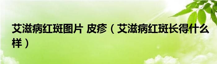 艾滋病紅斑圖片 皮疹（艾滋病紅斑長得什么樣）