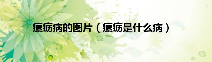 瘰疬病的圖片（瘰疬是什么?。?class='thumb lazy' /></a>
		    <header>
		<h2><a  href=