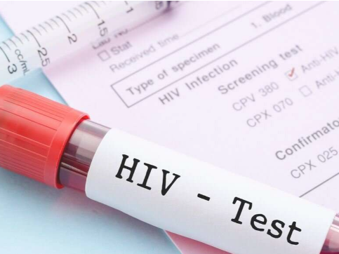 為什么有些人不用藥物就能抑制 HIV 的新線索