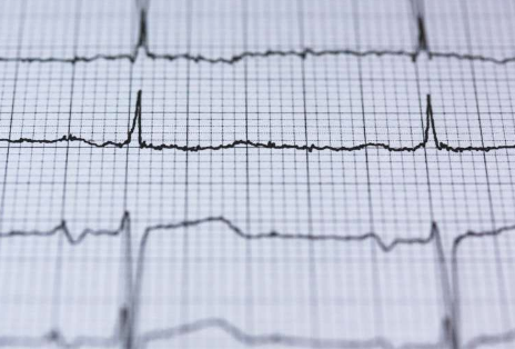 人工智能增強心電圖可以加速心力衰竭的診斷和治療