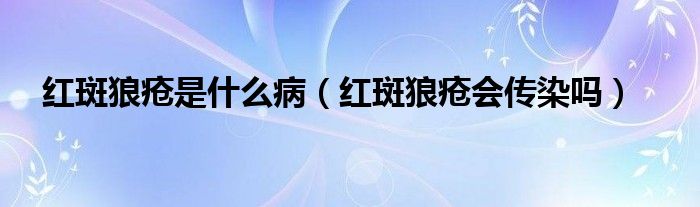 紅斑狼瘡是什么?。t斑狼瘡會傳染嗎）