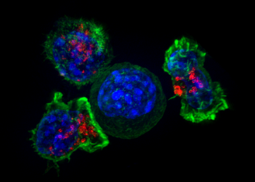 融合生物學和物理科學可以更深入地了解癌癥