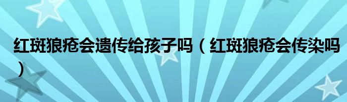 紅斑狼瘡會遺傳給孩子嗎（紅斑狼瘡會傳染嗎）