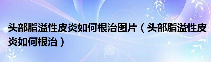 頭部脂溢性皮炎如何根治圖片（頭部脂溢性皮炎如何根治）