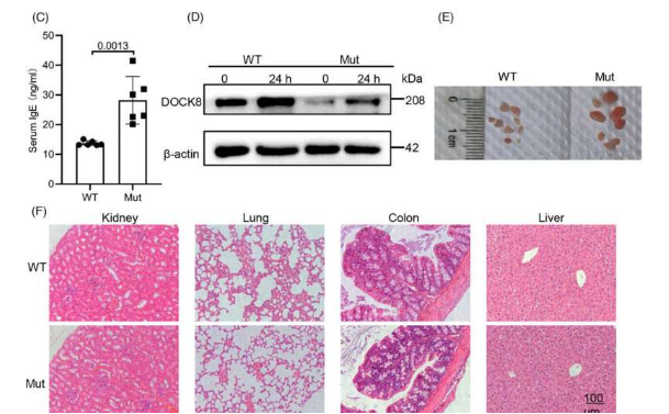 研究：DOCK8突變通過(guò)調(diào)節(jié)糖酵解途徑破壞輔助T細(xì)胞分化