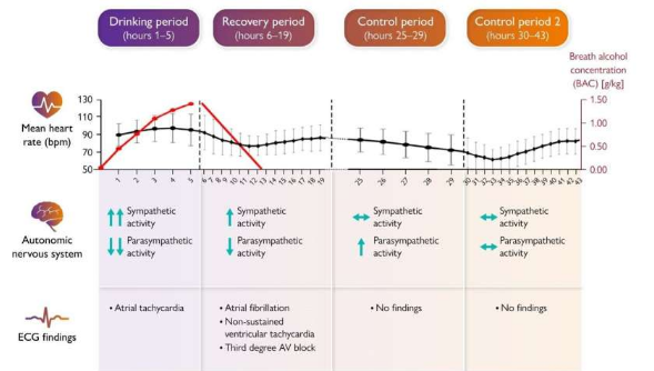 心電圖監(jiān)測(cè)研究發(fā)現(xiàn)過(guò)量飲酒后心律失常