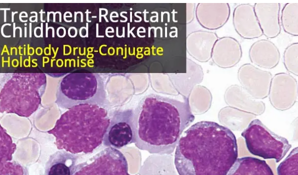 抗體藥物結(jié)合靶向治療抗性兒童白血病