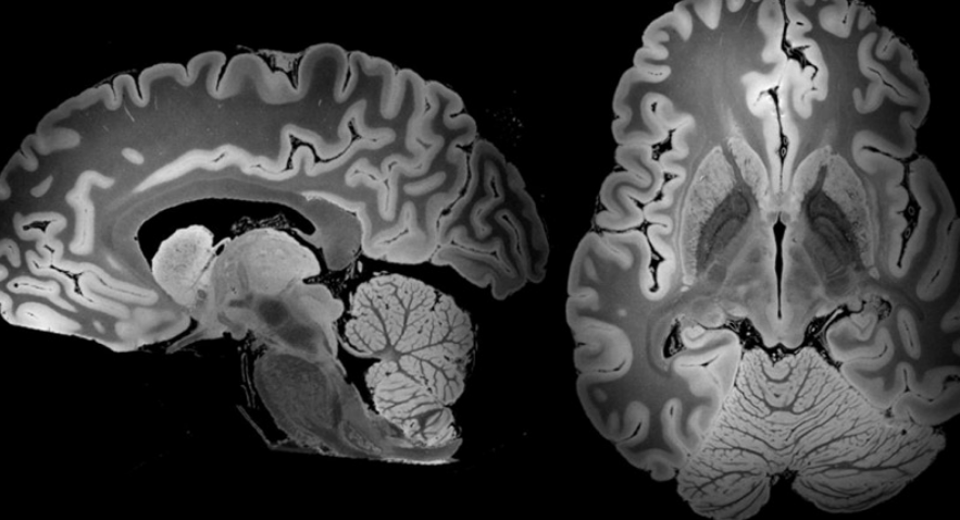 100小時的MRI掃描捕獲了整個人腦的最詳細外觀